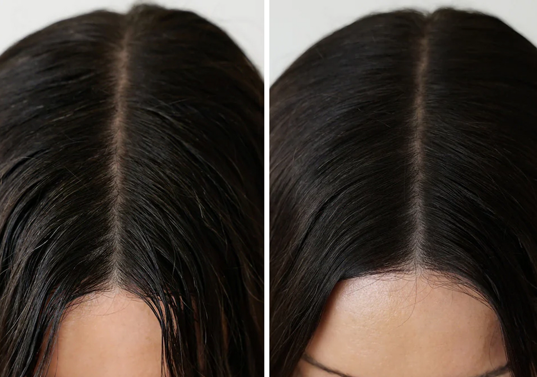 The Scalp Detox: Why a Healthy Foundation is the Secret to Professional Shine
